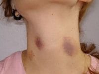 Ilustrasi Bekas Cupangan