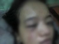 Korban penganiayaan oknum polisi di Takalar. (Ist)