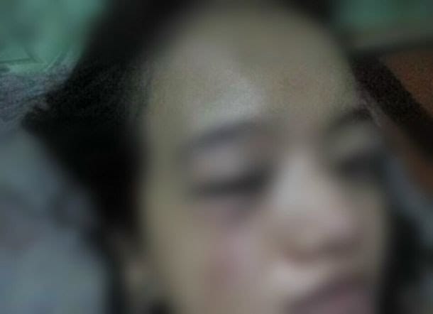 Korban penganiayaan oknum polisi di Takalar. (Ist)