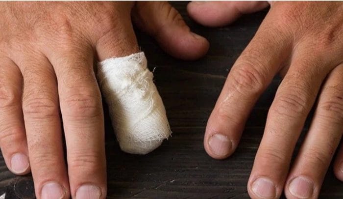 Ilustrasi Pria Potong Jari Setelah Digigit Ular © Shutterstock