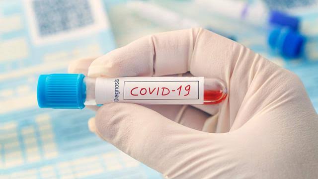 ilustrasi virus corona covid-19 (Foto: Shutterstock)