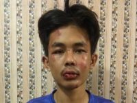 Pelaku penusukan Syekh Ali Jaber. (Istimewa)