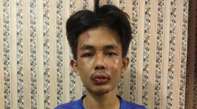 Pelaku penusukan Syekh Ali Jaber. (Istimewa)